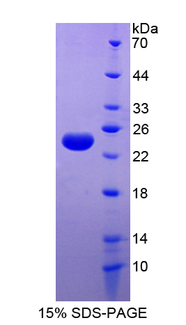 Recombinant Ferritin, Light Polypeptide (FTL)