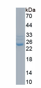 Recombinant Ferritin, Light Polypeptide (FTL)