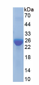 Recombinant Ferritin, Light Polypeptide (FTL)