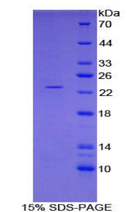 Recombinant Ferritin, Heavy Polypeptide (FTH)