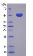 Recombinant Calcium/Calmodulin Dependent Protein Kinase I (CAMK1)