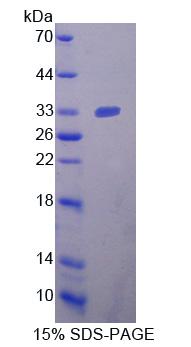 Recombinant Neuropilin 2 (NRP2)