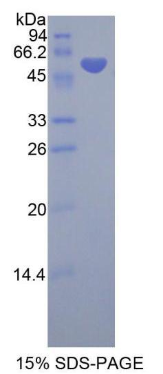 Recombinant Neutral Sphingomyelinase (NSMASE)