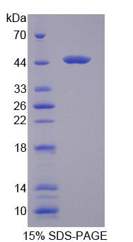 RPD061Hu01.jpg