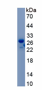 Recombinant Apelin Receptor (APLNR)