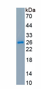 Recombinant Carbonic Anhydrase IV (CA4)