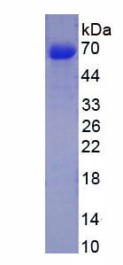 Recombinant Carbonic Anhydrase VI (CA6)