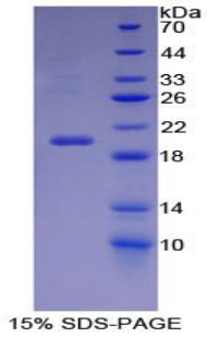 Recombinant Carbonic Anhydrase VI (CA6)