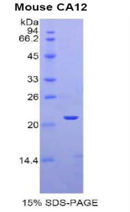 Recombinant Carbonic Anhydrase XII (CA12)