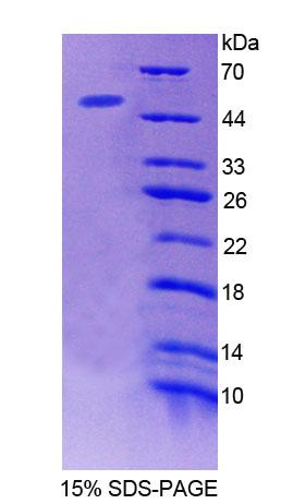 Recombinant Acid Phosphatase 6, Lysophosphatidic (ACP6)