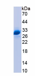 Recombinant Acid Phosphatase 2, Lysosomal (ACP2)