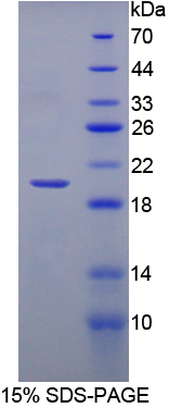 Recombinant Hemoglobin Beta (HBb)