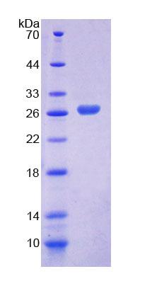 RPD103Hu01.jpg