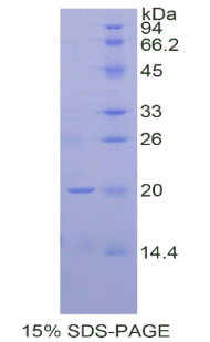 Recombinant Hedgehog Homolog, Indian (IHH)