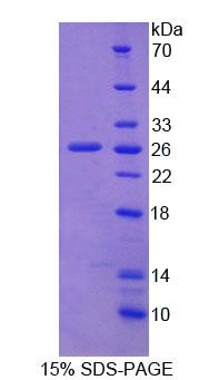 Recombinant Fibulin 2 (FBLN2)