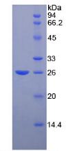 Recombinant Fibulin 2 (FBLN2)