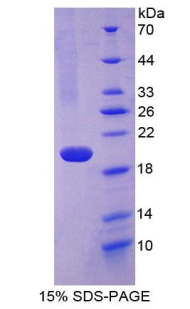 Recombinant Fibulin 5 (FBLN5)