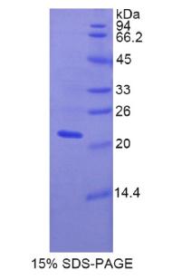 Recombinant Fibulin 5 (FBLN5)