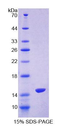 RPD159Hu01.jpg