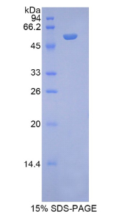 Recombinant N-Acetyl Alpha-D-Glucosaminidase (NAGLU)