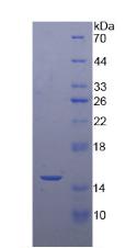 Recombinant Ribonuclease III, Nuclear (RNASEN)