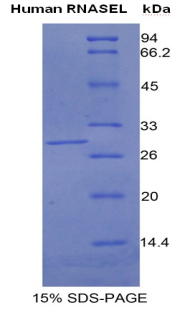 Recombinant Ribonuclease L (RNASEL)