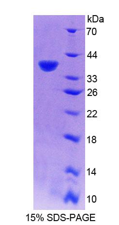 Recombinant Ribonuclease H2 Subunit A (RNASEH2A)