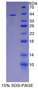 Recombinant Paraoxonase 2 (PON2)