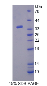 Recombinant Paraoxonase 2 (PON2)