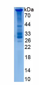 Recombinant Mucin 21 (MUC21)