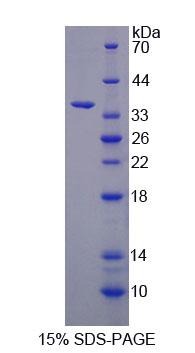 Recombinant Mannosyl Oligosaccharide Glucosidase (MOGS)