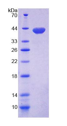 Recombinant Mannosyl Oligosaccharide Glucosidase (MOGS)