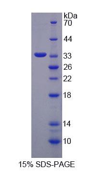 Recombinant Glucosidase Alpha, Neutral AB (GaNAB)