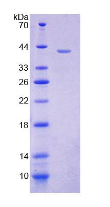 Recombinant Glucosidase Alpha, Neutral AB (GaNAB)