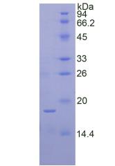 Recombinant Ribonuclease A7 (RNASE7)