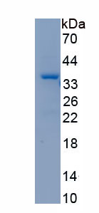 Recombinant Sequestosome 1 (SQSTM1)