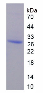 Recombinant Sjogren Syndrome Antigen B (SSB)