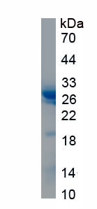 Recombinant Sjogren Syndrome Antigen A1 (SSA1)