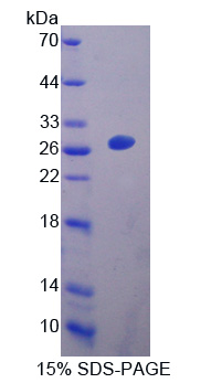 Recombinant Epstein Barr Virus Induced Protein 3 (EBI3)