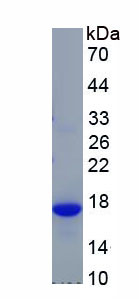 Recombinant Thyroid Stimulating Hormone Beta (TSHb)