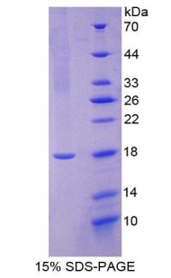 Recombinant Chorionic Gonadotropin Beta Polypeptide (CGb)