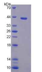 Recombinant Prothymosin Alpha (PTMa)