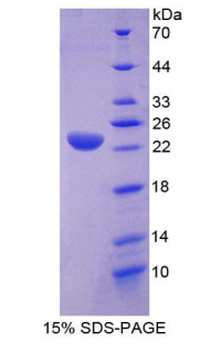 Recombinant Lipase A, Lysosomal Acid (LIPA)