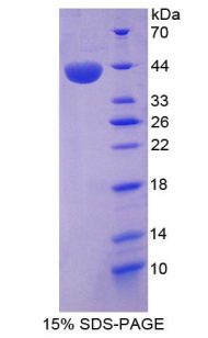 Recombinant Lipase A, Lysosomal Acid (LIPA)