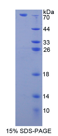 Recombinant Lipase, Gastric (LIPF)