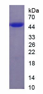 Recombinant Troponin C Type 2, Fast (TNNC2)