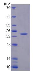 Recombinant Troponin I Type 1, Slow Skeletal (TNNI1)