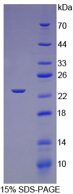 Recombinant Troponin I Type 1, Slow Skeletal (TNNI1)