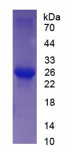 Recombinant Troponin I Type 2, Fast Skeletal (TNNI2)