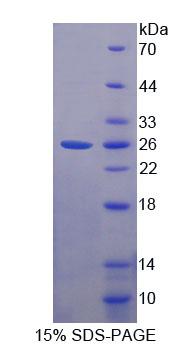 Recombinant Troponin I Type 2, Fast Skeletal (TNNI2)